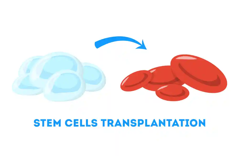 Autologous and Allogeneic Transplant Stem Cell Transplant